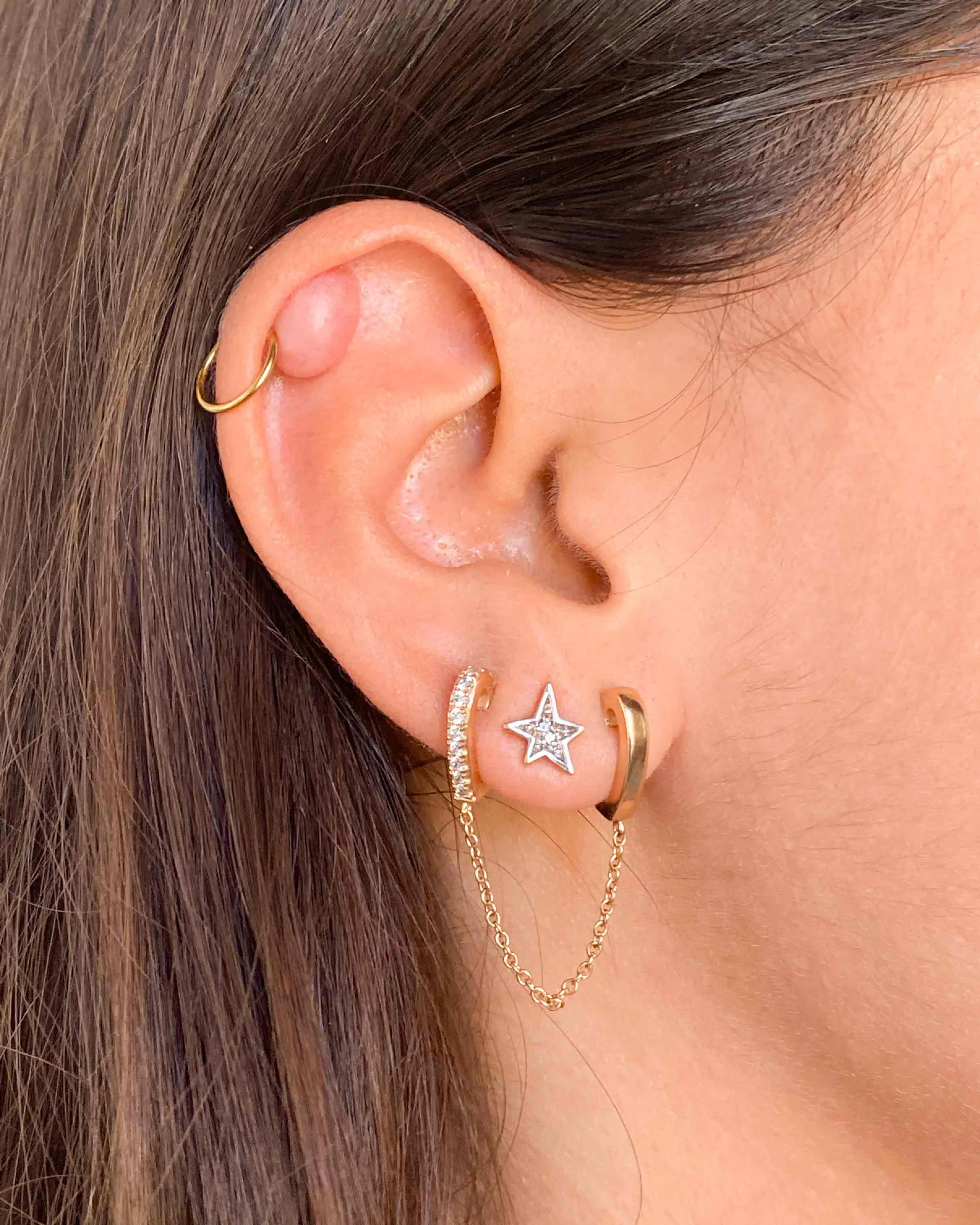 La Chéloïde c’est quoi et comment le soigner ?